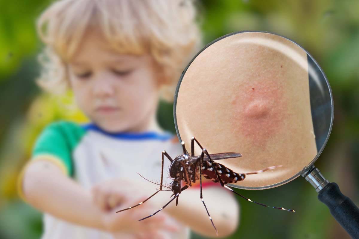 Come proteggere al meglio i bambini dalle zanzare