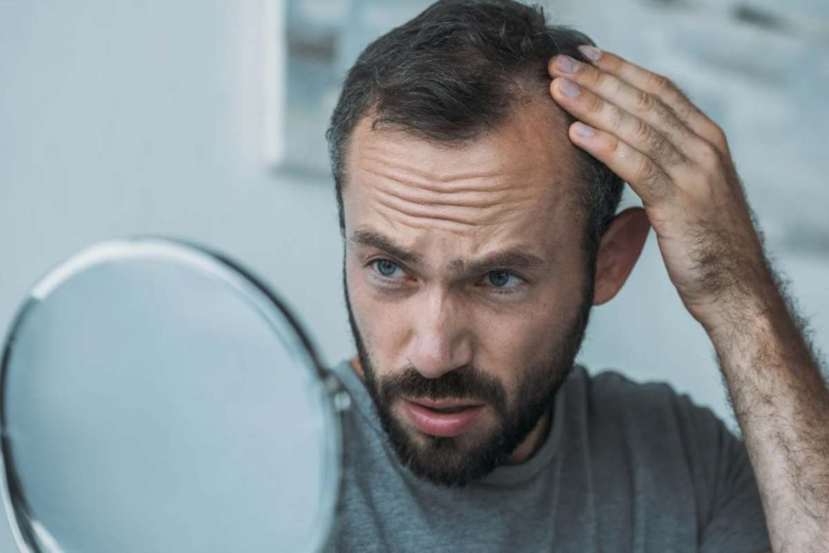 Caduta capelli, cause e rimedi