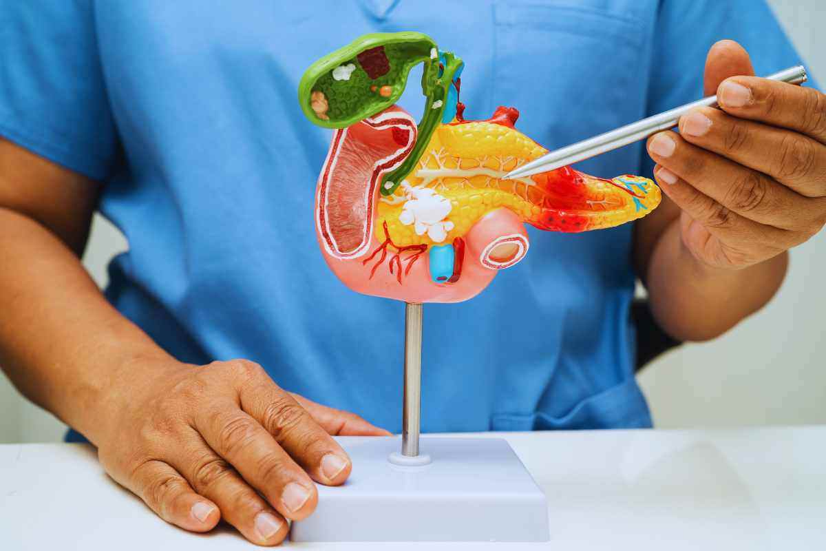 tumore al pancreas: cure e aspettativa di vita