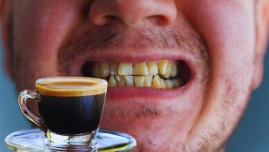 denti gialli a causa del caffè