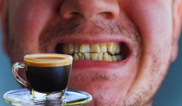 denti gialli a causa del caffè