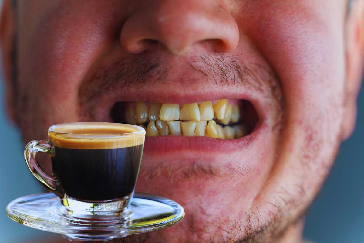 denti gialli a causa del caffè